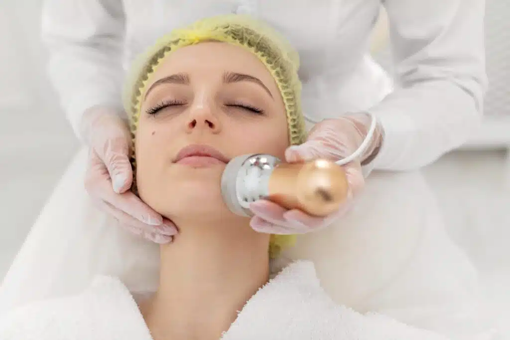 laser hair removal keowna