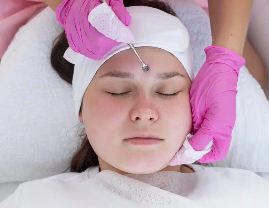 laser hair removal keowna