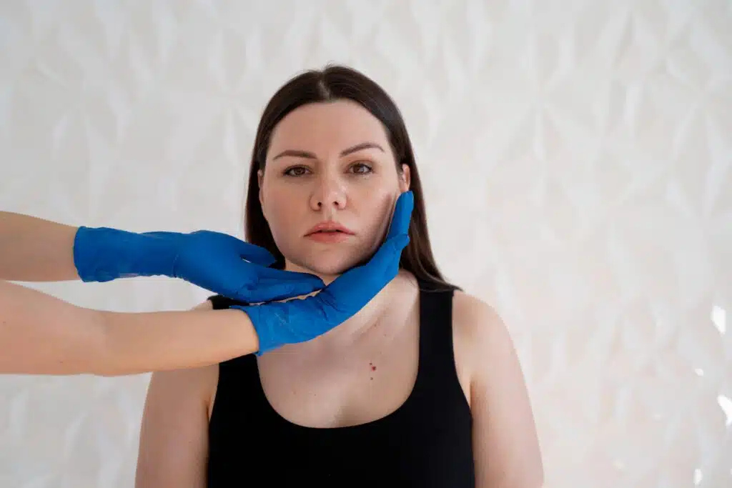 laser hair removal keowna