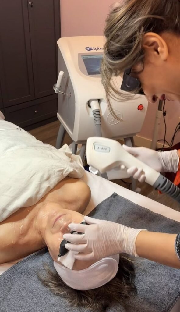 3D IPL PHOTOFACIAL TREATMENT AT MARZI SKINCARE KELOWNA